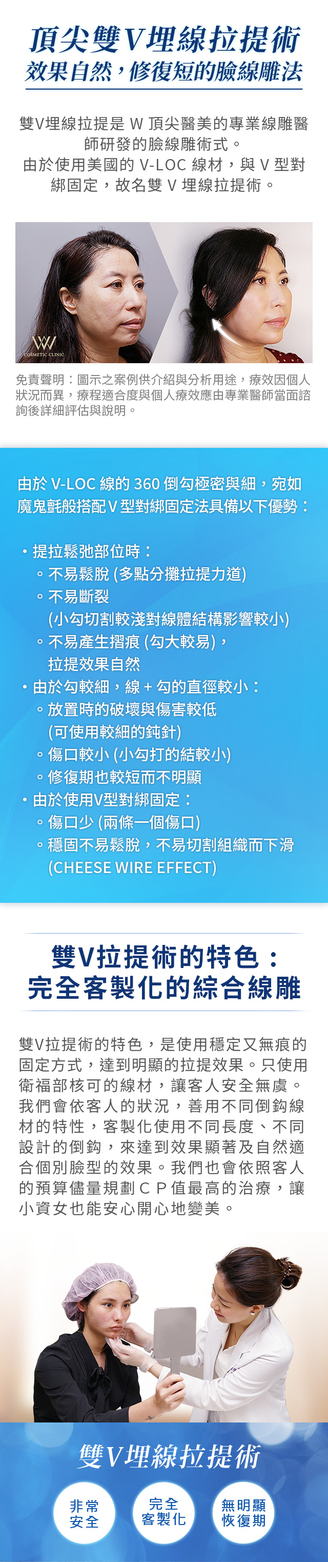 頂尖雙V埋線拉提術 雙V拉提術的特色 完全客製化的綜合線雕